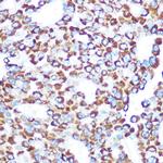 TAB3 Polyclonal Antibody