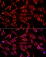 VDAC2 Polyclonal Antibody