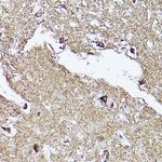 VDAC2 Antibody in Immunohistochemistry (Paraffin) (IHC (P))