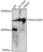ULK1/ULK2 Polyclonal Antibody