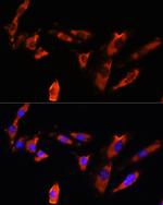 CDH8 Polyclonal Antibody