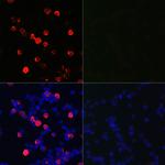 SARS-CoV-2 Nucleocapsid Polyclonal Antibody