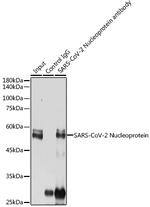 SARS-CoV-2 Nucleocapsid Antibody in Immunoprecipitation (IP)
