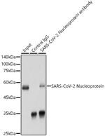 SARS-CoV-2 Nucleocapsid Antibody in Immunoprecipitation (IP)