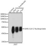 SARS-CoV-2 Nucleocapsid Antibody in Western Blot (WB)