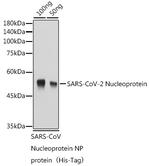 SARS-CoV-2 Nucleocapsid Antibody in Western Blot (WB)