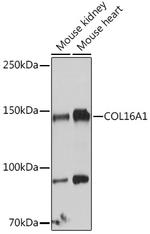 COL16A1 Antibody in Western Blot (WB)