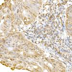 RNF126 Antibody in Immunohistochemistry (Paraffin) (IHC (P))