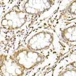 RNF126 Antibody in Immunohistochemistry (Paraffin) (IHC (P))