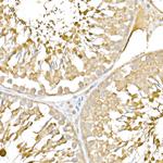 RNF126 Antibody in Immunohistochemistry (Paraffin) (IHC (P))