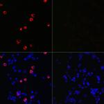 SARS-CoV-2 Spike Protein S2 Polyclonal Antibody