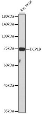 DCP1B Antibody in Western Blot (WB)