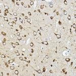 ATP6V1G2 Antibody in Immunohistochemistry (Paraffin) (IHC (P))