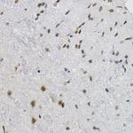 DNAJC17 Antibody in Immunohistochemistry (Paraffin) (IHC (P))