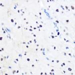 ZNF207 Polyclonal Antibody