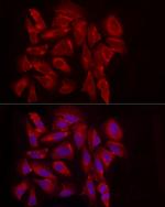 EXT1 Antibody in Immunocytochemistry (ICC/IF)