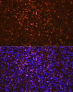 NGAL Polyclonal Antibody