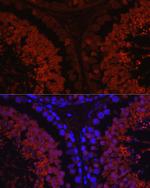SPAM1 Antibody in Immunocytochemistry (ICC/IF)