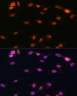 ALOX5 Polyclonal Antibody