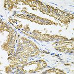 HLA-DQA1 Antibody in Immunohistochemistry (Paraffin) (IHC (P))