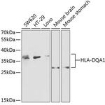 HLA-DQA1 Antibody in Western Blot (WB)