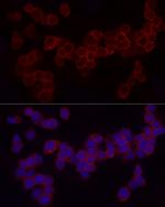 CD18 Antibody in Immunocytochemistry (ICC/IF)