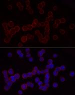 CD18 Antibody in Immunocytochemistry (ICC/IF)