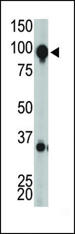 mGluR8 Polyclonal Antibody