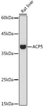 Tartrate Resistant Acid Phosphatase Antibody in Western Blot (WB)
