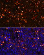 CLEC4D Polyclonal Antibody