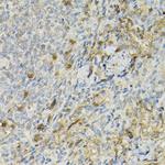 CD25 Antibody in Immunohistochemistry (Paraffin) (IHC (P))