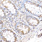 MMP17 Antibody in Immunohistochemistry (Paraffin) (IHC (P))