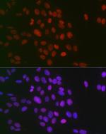 H3R26me2s Polyclonal Antibody