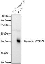 NGAL Polyclonal Antibody
