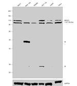 NR3C2 Antibody in Western Blot (WB)