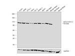 alpha Actinin 2 Antibody