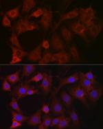 eIF4E2 Antibody in Immunocytochemistry (ICC/IF)