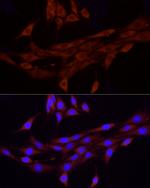 PIEZO1 Antibody in Immunocytochemistry (ICC/IF)