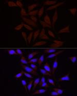 PIEZO1 Antibody in Immunocytochemistry (ICC/IF)