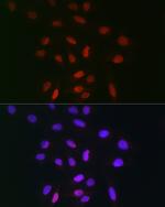 TDP1 Polyclonal Antibody