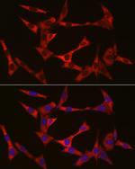 WIF1 Polyclonal Antibody