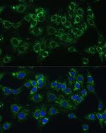 Cytochrome B5 Polyclonal Antibody