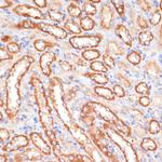 Cytochrome B5 Antibody in Immunohistochemistry (Paraffin) (IHC (P))