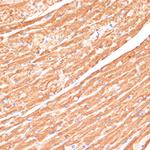 Cytochrome B5 Antibody in Immunohistochemistry (Paraffin) (IHC (P))