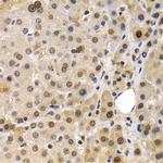 MAGE1 Antibody in Immunohistochemistry (Paraffin) (IHC (P))