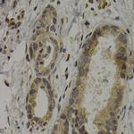 MAGE1 Antibody in Immunohistochemistry (Paraffin) (IHC (P))
