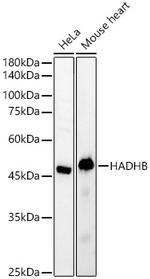 HADHB Antibody in Western Blot (WB)