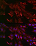 RMDN3 Antibody in Immunocytochemistry (ICC/IF)