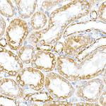 RMDN3 Antibody in Immunohistochemistry (Paraffin) (IHC (P))