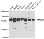 RMDN3 Antibody in Western Blot (WB)
